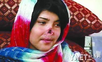 阿富汗 割鼻 女孩整容后首亮相 曾登 时代 封面